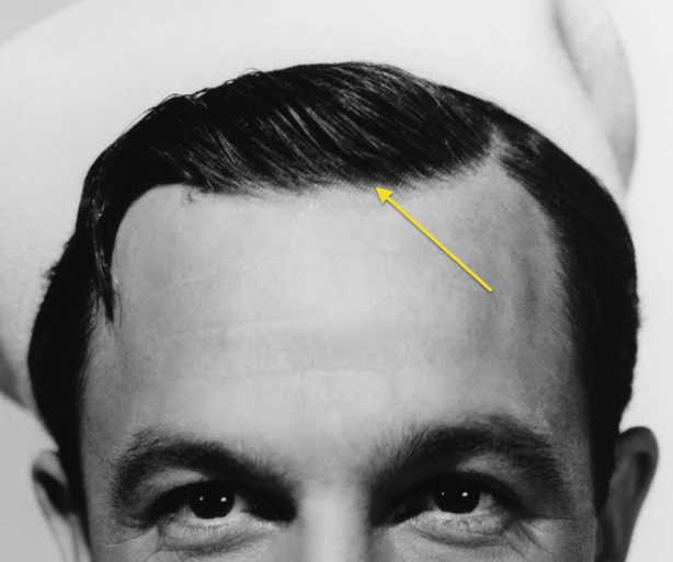 Gene Kelly wearing a hairpiece